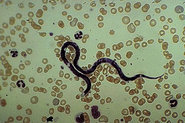 parasito subcutáneo Filaria
