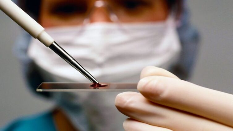 Mostra de sangue
