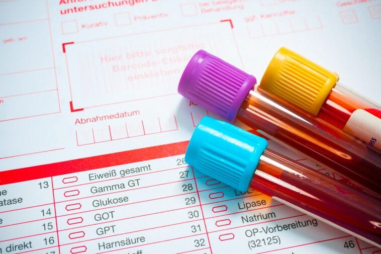 Sangue para a investigación sobre parásitos