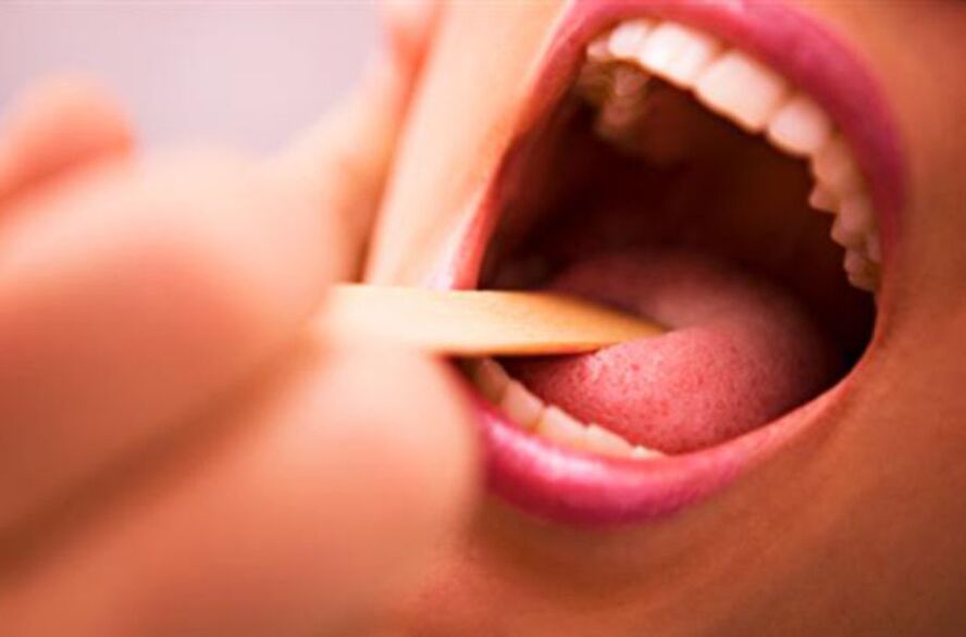 Tipos de parasitos na boca humana